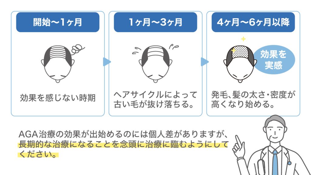 AGA治療の効果はどの位の期間で出るの？