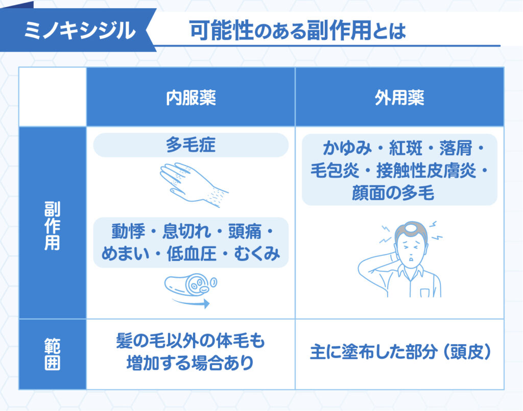 ミノキシジルの副作用とは？