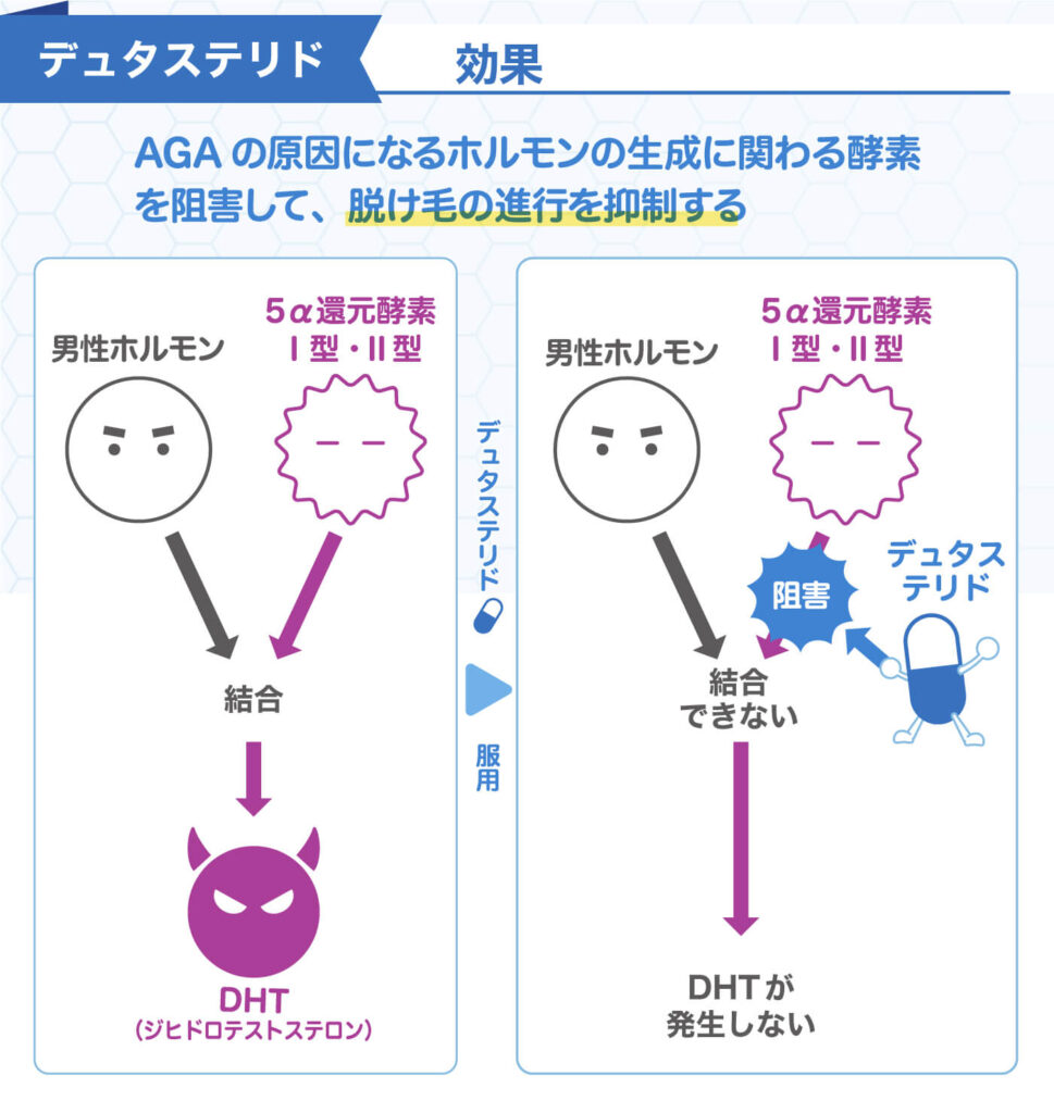 デュタステリドの効果