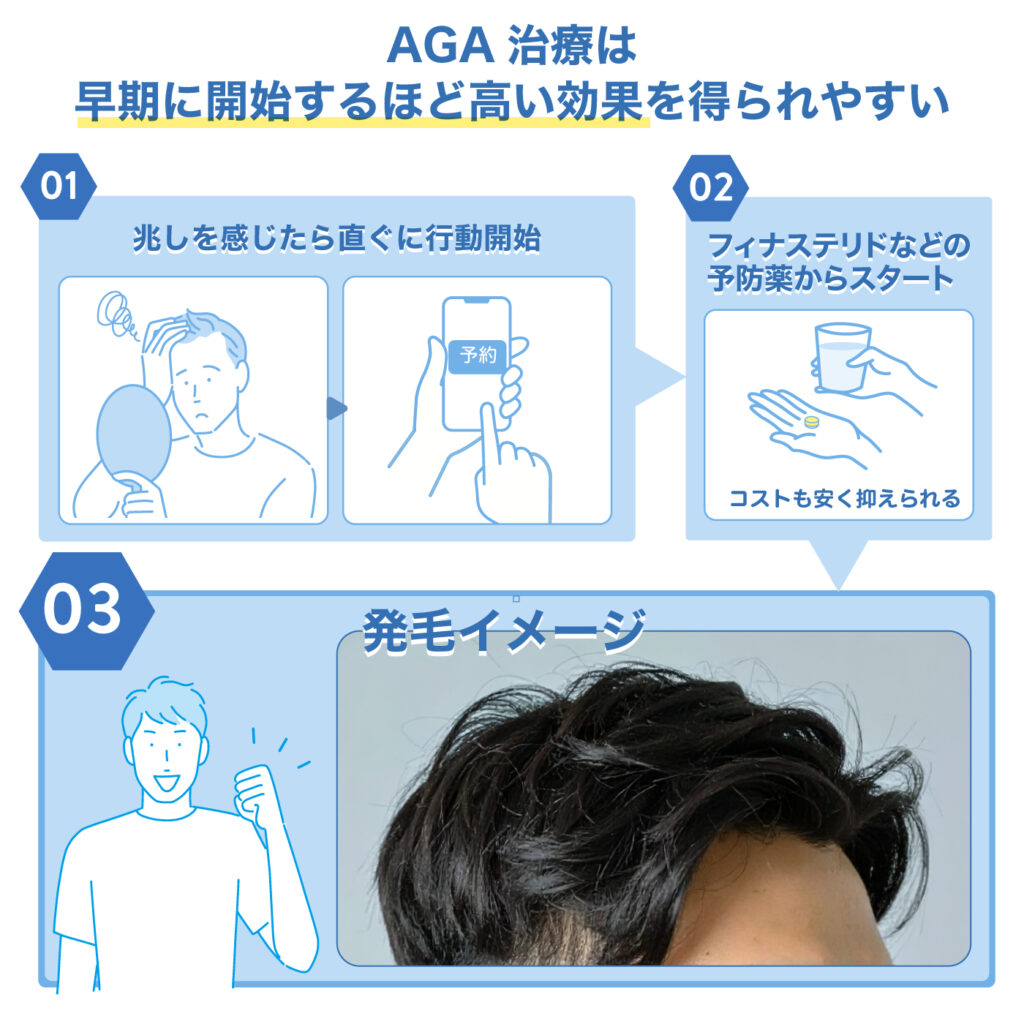 AGA治療の早期開始